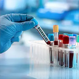Toma de Muestras Laboratorio